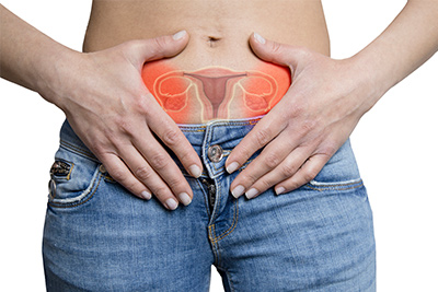 endometriosis