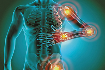 inflammation