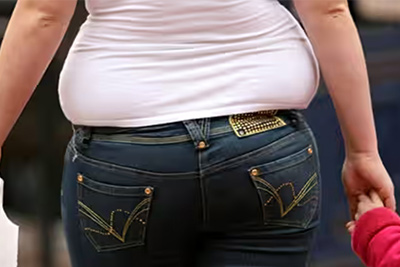 type2Diabetes